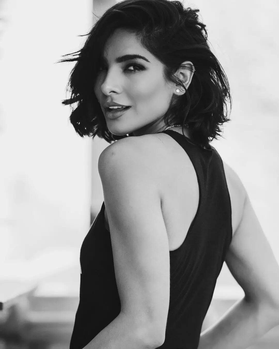 Beauty queen Alejandra Espinoza hospitalized after suffering from face paralysis