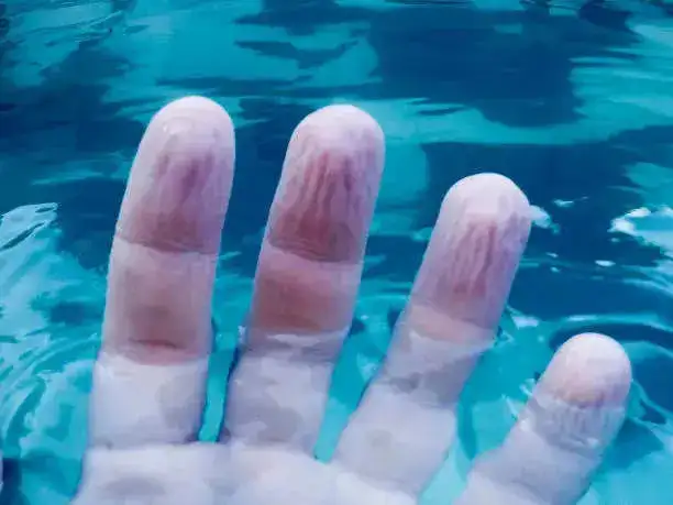 wrinkled fingers in water