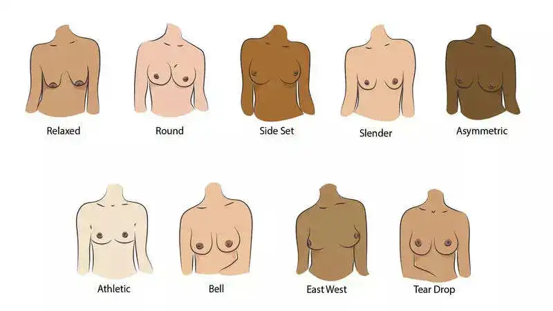 Know about the most common breast shapes