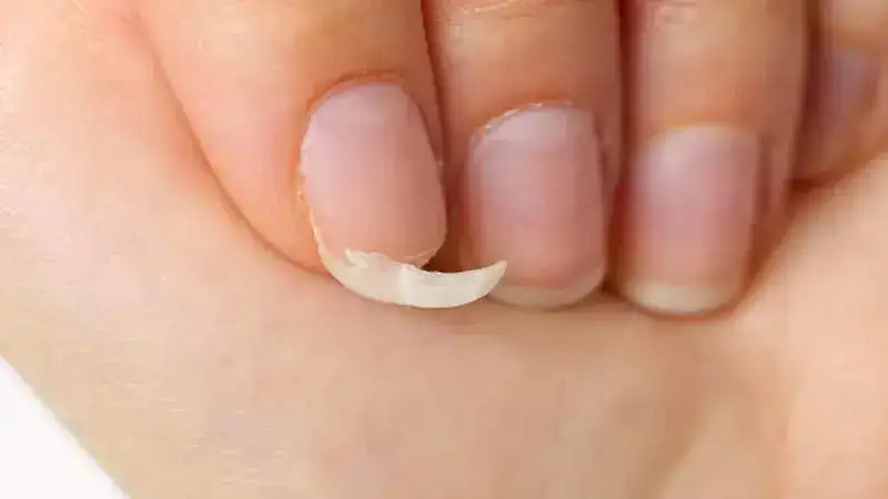 Brittle nails? Check out natural ways to keep it healthy