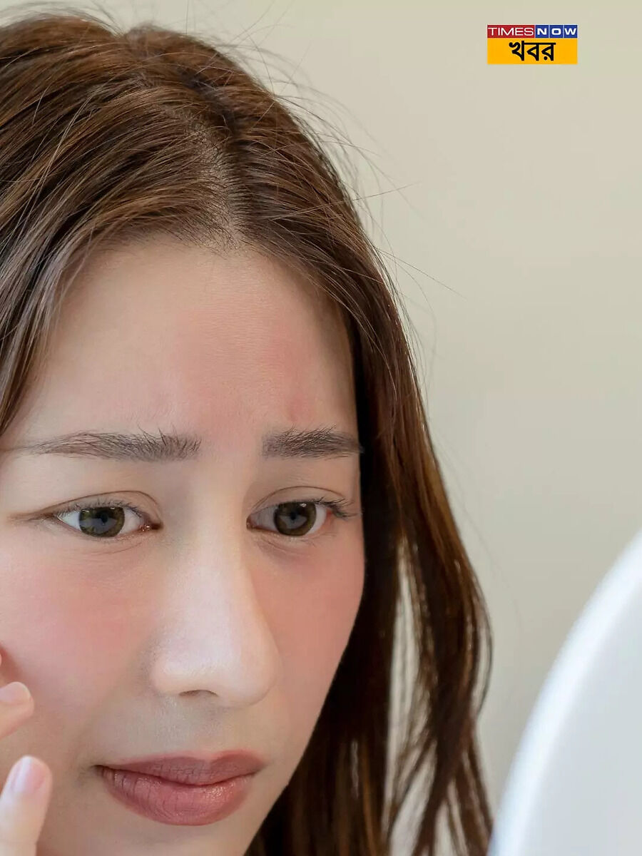 liver diseases beware of these 7 signs of fatty liver on skin face and ...