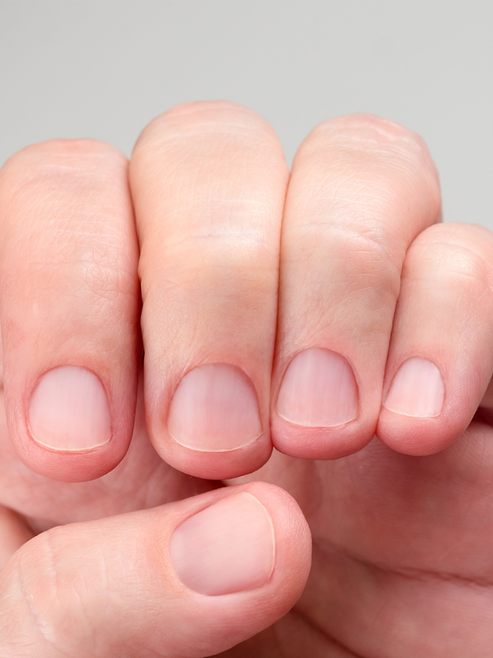 What Your Nails Reveal About Your Health | Health and Me