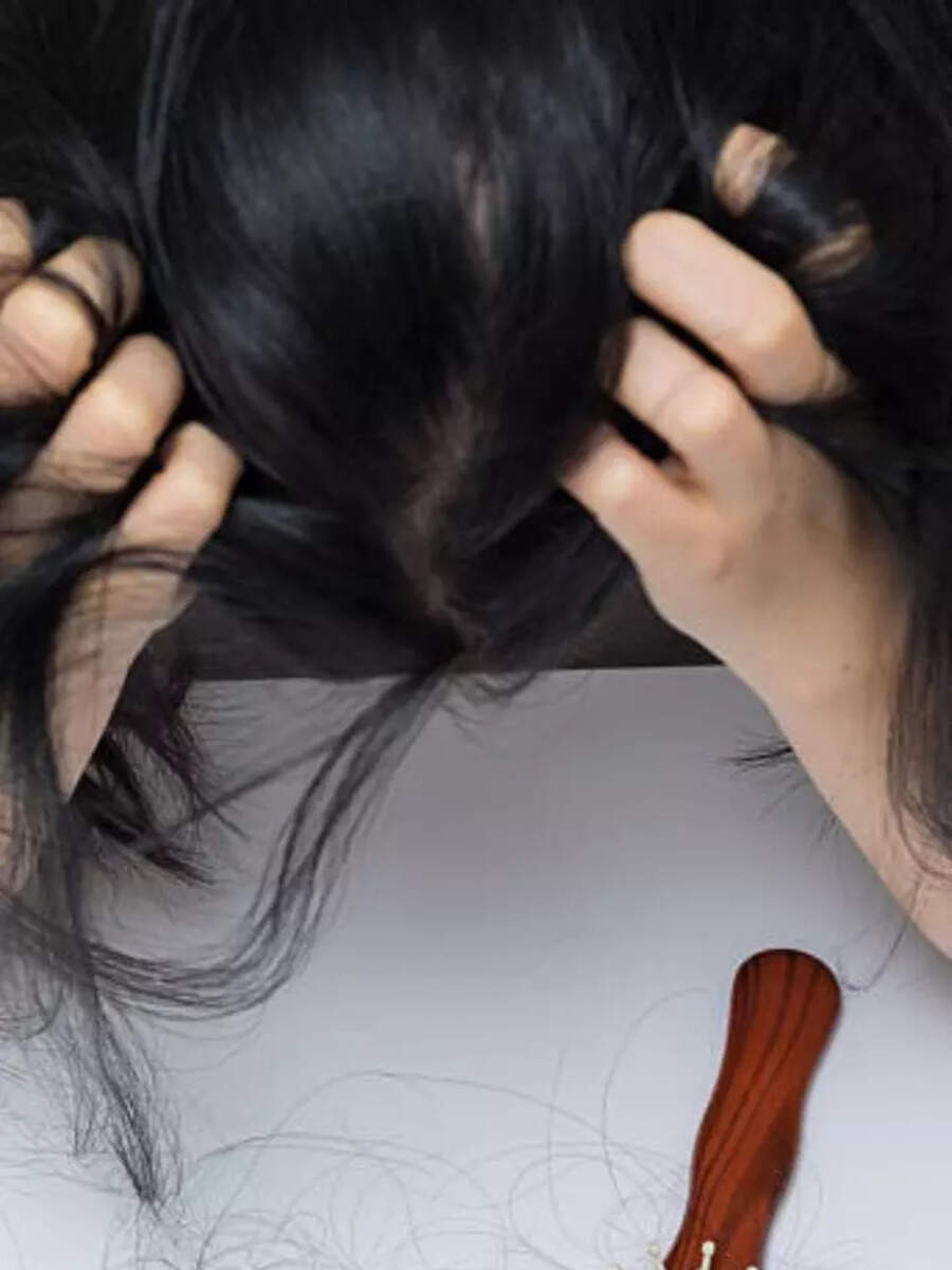  வெயில் காலம்... முடி ரொம்ப கொட்டுதா.. சிம்பிளான இந்த வைத்தியம் பத்தி தெரிஞ்சுக்கோங்க! 