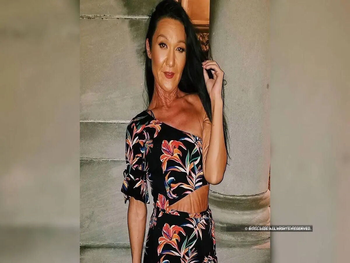 28-year-old model shares her story to inspire others
